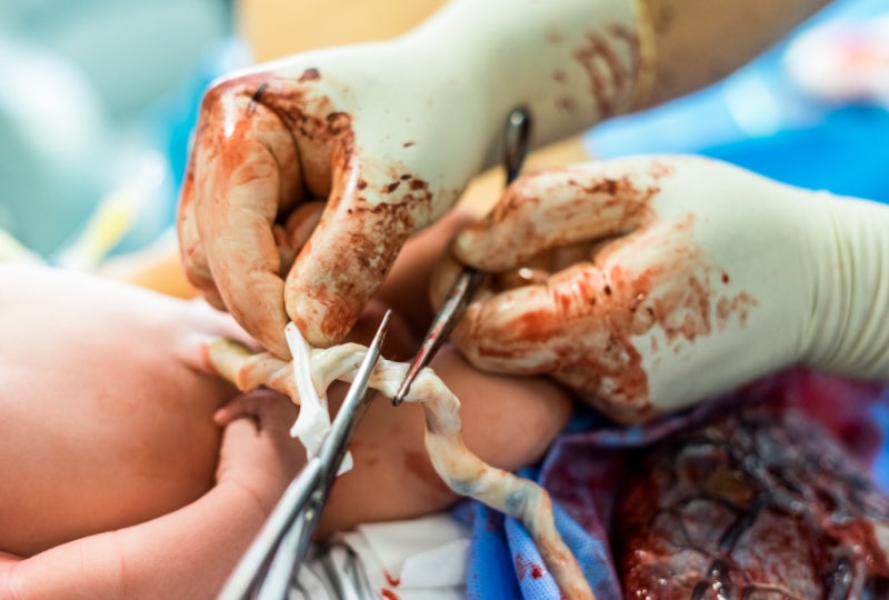 줄기세포 자폐증 치료법: 미국 FDA, 줄기세포 회사 Livyon에 경고