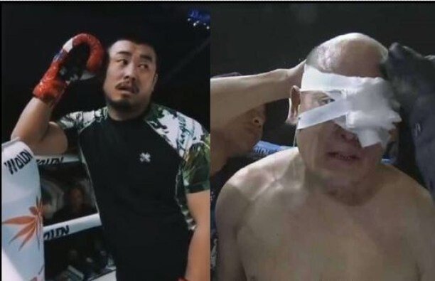 중국무술 개털어버린 중국 격투기 선수 쉬샤오둥 중국무술 개털어버린 중국 격투기 선수 쉬샤오둥