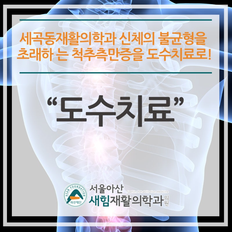 척추 측만증이 의심되는 증상에 문정동 정형외과