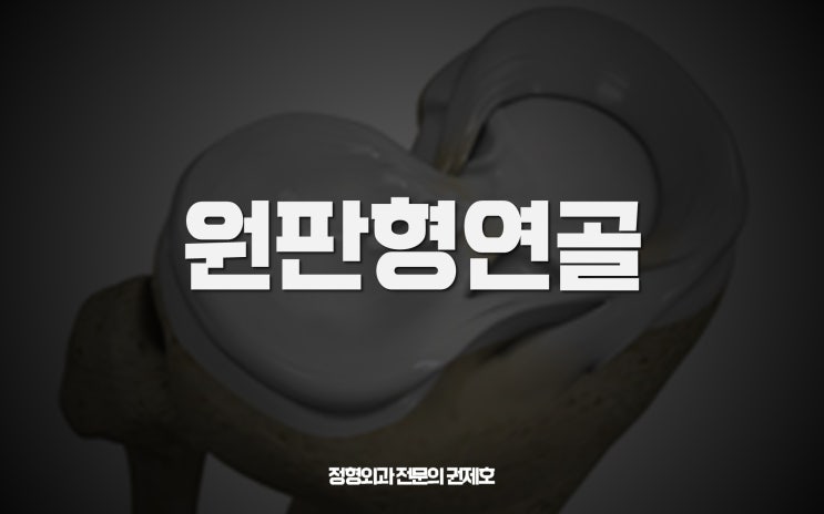  반월상연골 기형은 원판형 연골판 discoid, 원래 모양으로 절제