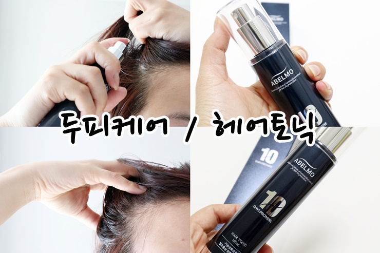  두피가려움 아벨모 헤어토닉으로 케어 하니 탈모관리까지 되네?!