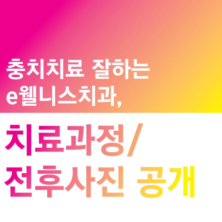  충치치료 잘하는 e웰니스치과, 치료과정/전후사진 공개