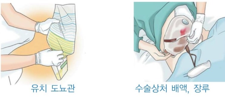  감염병 질환 예방!!! 2 _ 감염관리의 필요성