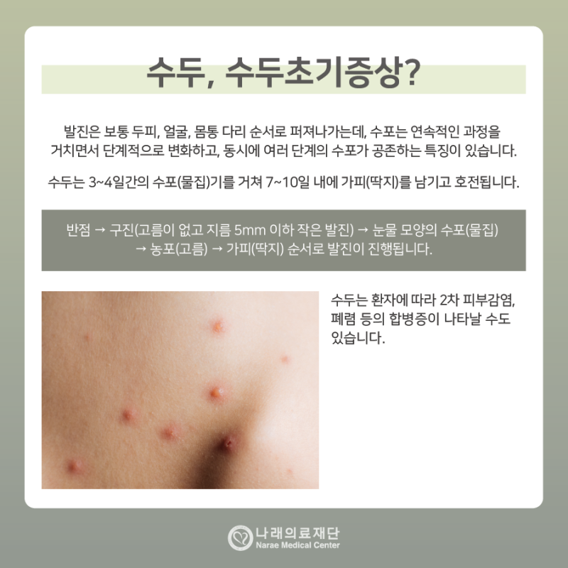 수두의 초기증상과 원인, 수두의 예방과 치료, 치과치료 시 주의사항