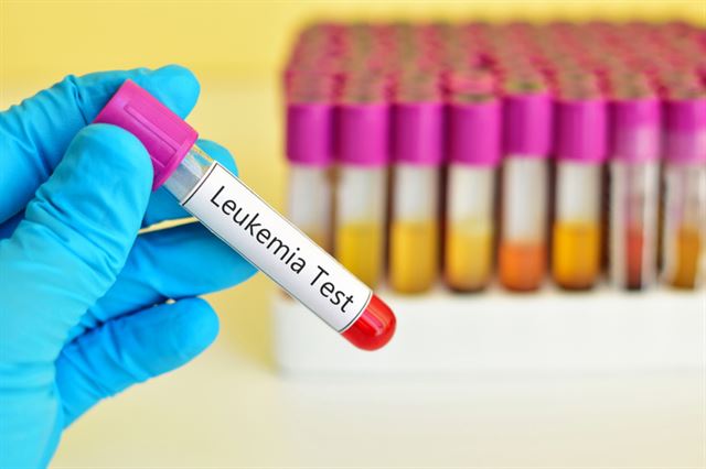 급성 골수성 백혈병 치료제 속속… 불치병에 도전