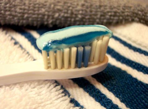 누런이 셀프 치아미백을 하는게 좋을까? 치과에서 미백 치료를 받는게 좋을까?