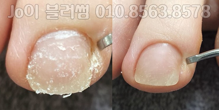  발톱 관리는 역시 용인 상현동 조이블러썸. 네일아트는 마법처럼 기분을 좋게 만들어 줍니다.