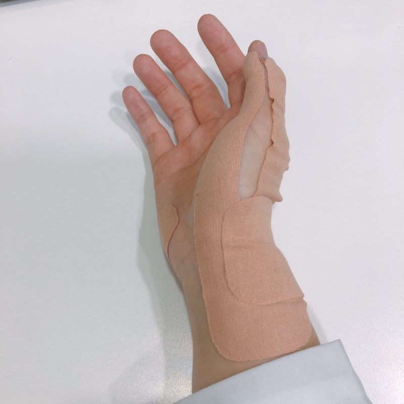 [테이핑 치료-엄지 손가락] "드퀘르벵 증후군" 테이핑 방법(엄지 손가락쪽 손목 통증/찌릿찌....