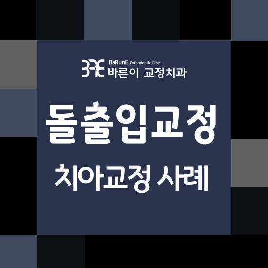 운정치아교정, 돌출입 치아교정 사례