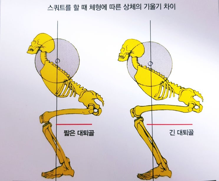  넓적다리(대퇴사두근) 운동 여자도 해야하나