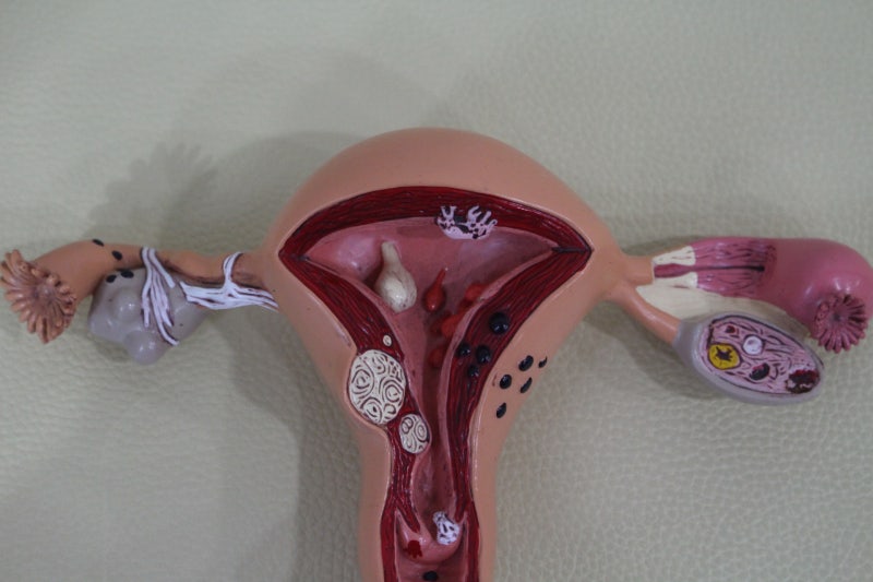 생리했는데 임신 가능할까? : 네이버 블로그