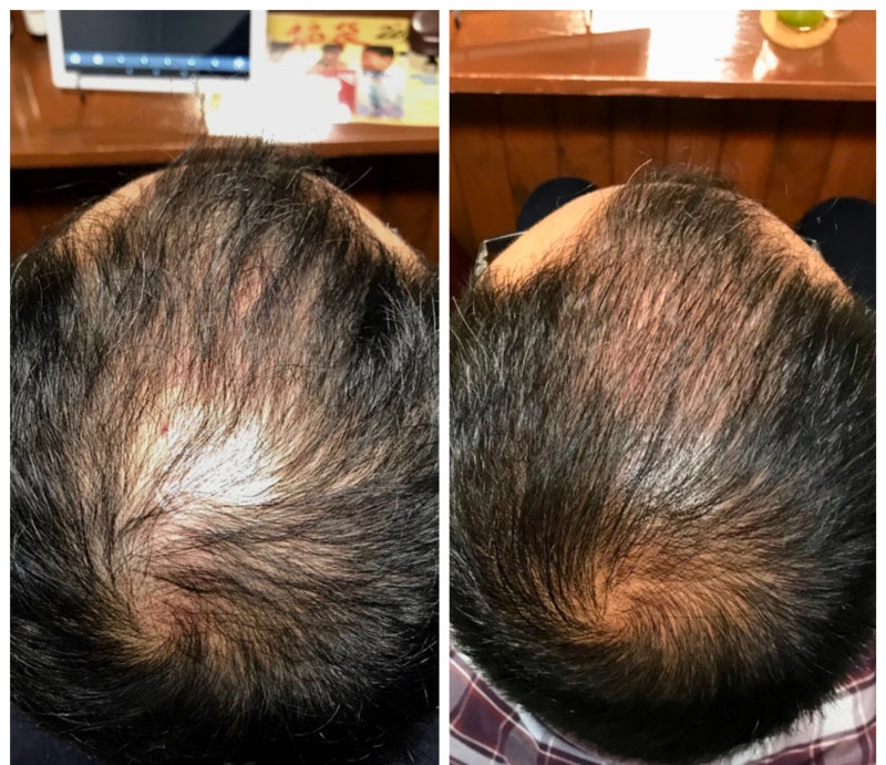 쉐이딩 현상(shedding): 접종자 옆에 있는 것만으로도 '스파이크 단백질'이 전염된다?