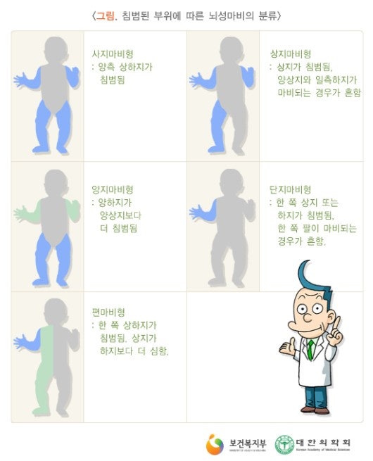 테트라 아멜리아 증후군 식이요법, 진단방법, 민간요법, 종류