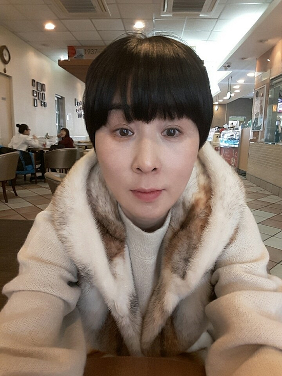  팔자주름실리프팅 어려보이는 비밀