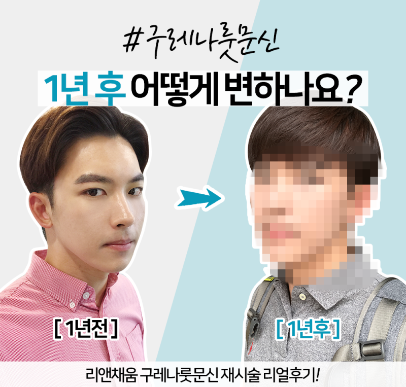 깔끔한 인상을 만들어주는 김포 여자 3