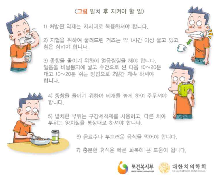  사랑니 발치④:: 발치 후 주의사항과 부작용 알아봐요