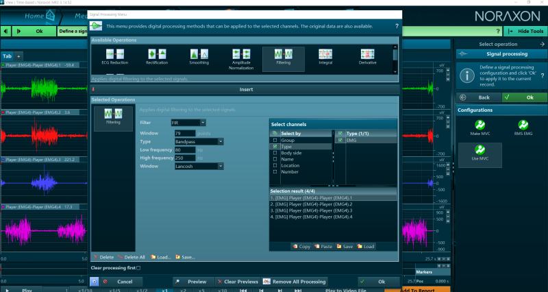 7. MR3 근활성도 Signal Processing 처리 방법 : 네이버 블로그
