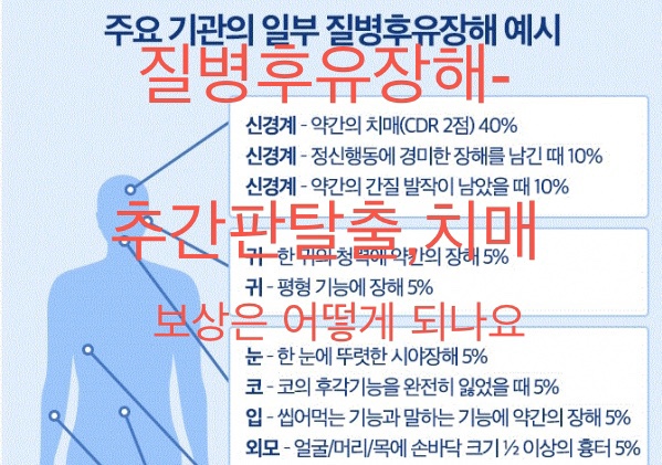  질병후유장해-치매와 추간판탈출-보상은 어떻게 되나요?