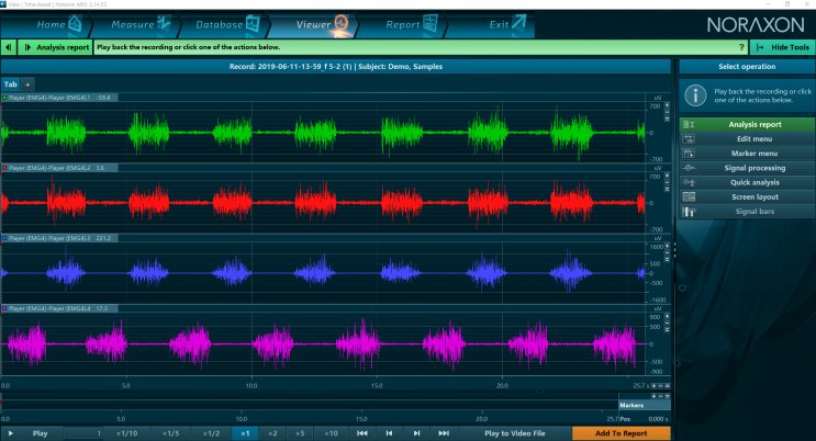  7. MR3 근활성도 Signal Processing 처리 방법