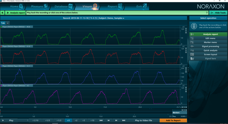 7. MR3 근활성도 Signal Processing 처리 방법 : 네이버 블로그