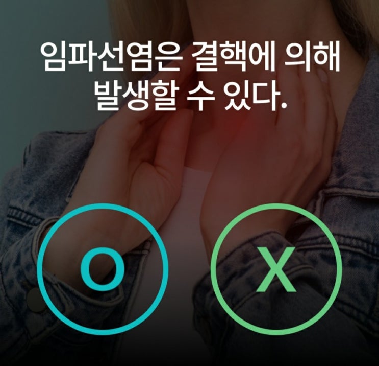  케어나우퀴즈 임파선염과 결핵