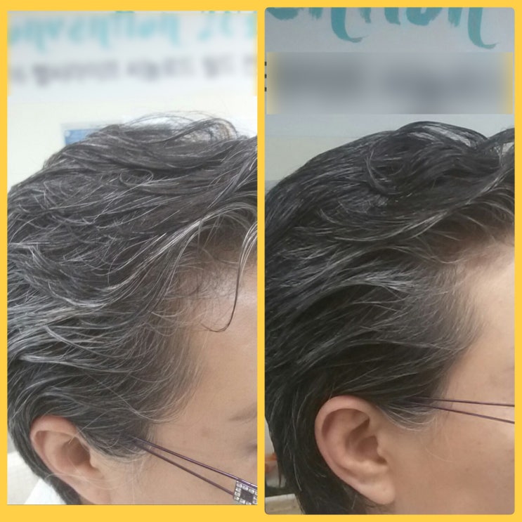 X-grey 천연비누 [씨놀비누] -두피건강/흰머리/탈모/얇은머리카락 고민... 씨놀비누사용후기/사용방법?