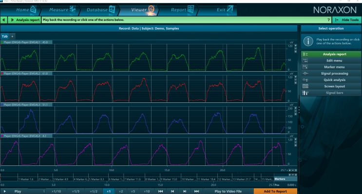  9. MR3 EMG Standard Amplitude Analysis 방법