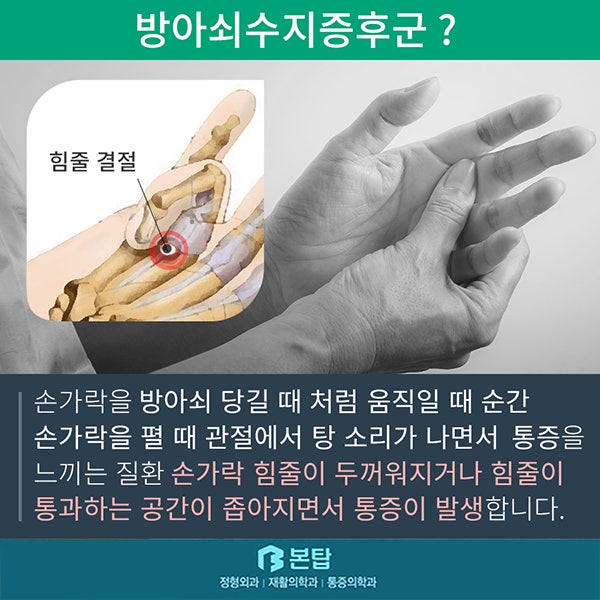 — 엄지쪽 손이 너무 아파요. 엄지 2
