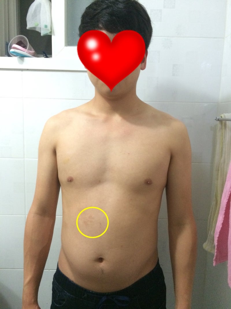 -14kg 이국주 테니스 다이어트 체지방을 빼는 방법 여성 남성의 뱃살 빼기 운동