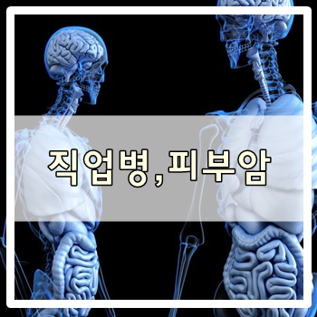  직업병, 피부암!