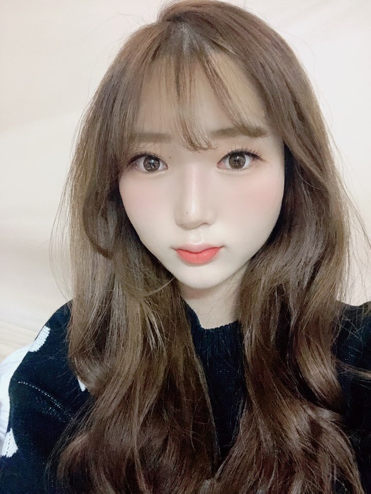  [인천 구월동] 이마&입술 필러 전문 피부과 : 이마필러 후기