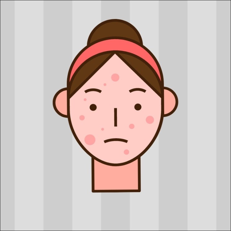  두피가 많이 간지러워요