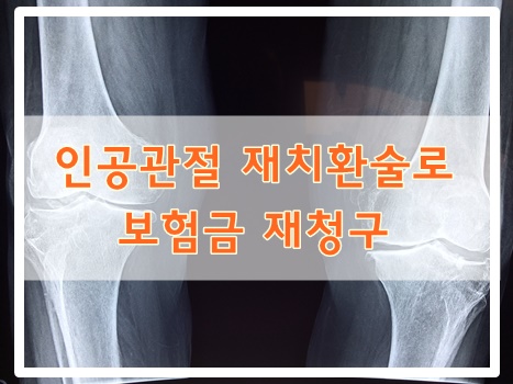  인공관절 재치환술로 보험금 재청구