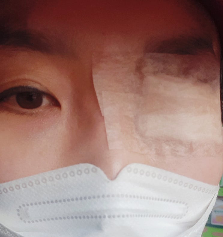  다래끼 나서 째고 왔어요. 강서구 조은안과 추천합니다.