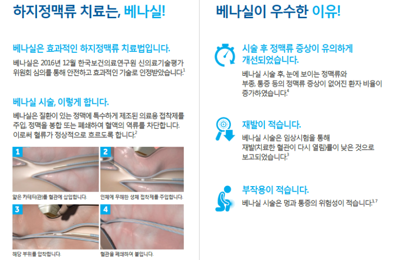 부천하지정맥류병원, 조기진단으로 수술 없이 치료!