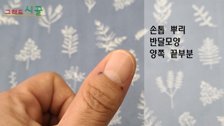 면역력 높이는 간단한 맛사지 손끝지압법