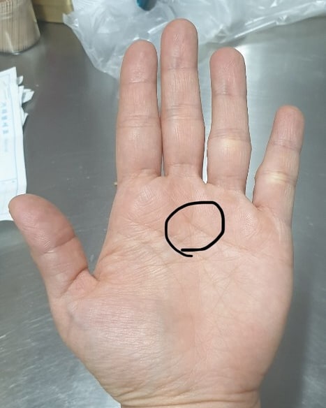  손금을 봤는데 양손 다 신비십자가 있네요