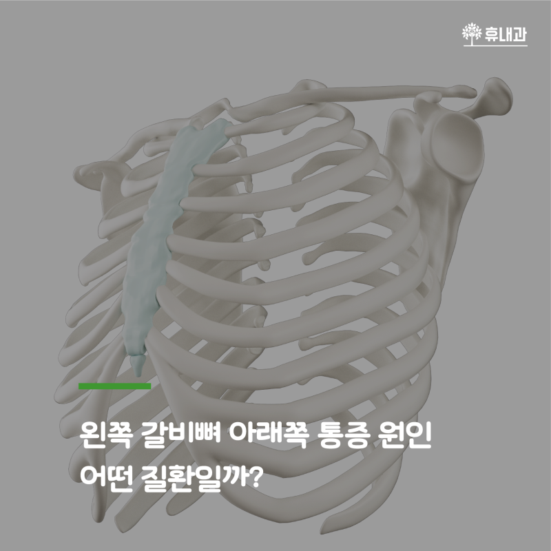 여자 왼쪽 갈비뼈 아래 통증 원인 인천소화기내과 네이버 블로그