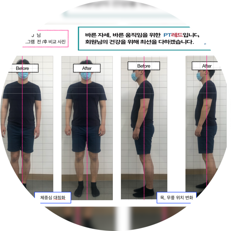  대구척추교정 바른자세 만들어요