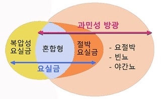 과민성 방광의 원인 및 증상, 치료 예방 생활 가이드 6