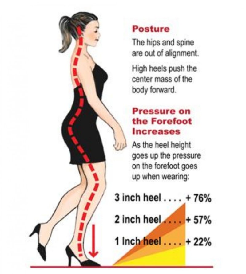 자세교정 골반전방경사와 엉치뼈통증 : 네이버 블로그