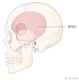 관자놀이가 꺼지는 이유! 대구마리의원 땅콩 필러, 옆볼꺼짐필러, 치아교정 후 볼 꺼짐 필러 : 네이버 블로그 관자놀이가 꺼지는 이유! 대구마리의원 땅콩 필러, 옆볼꺼짐필러, 치아교정 후 볼 꺼짐 필러 : 네이버 블로그