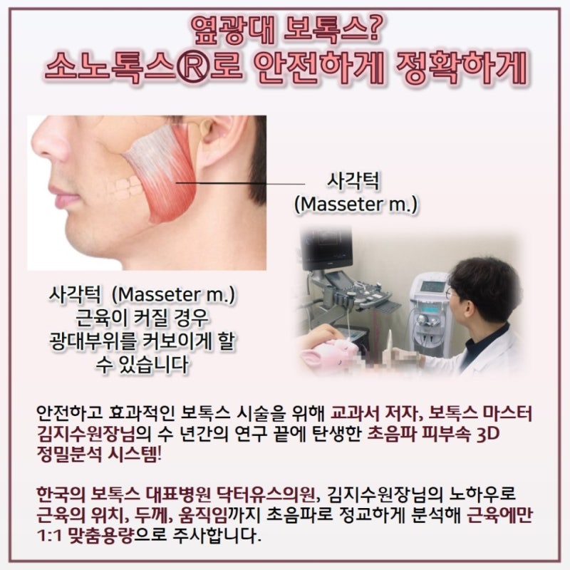 옆 광대 줄이는 법 2: 보톡스? 윤곽 주사? 14