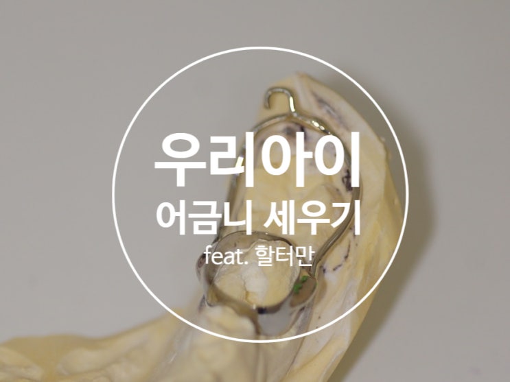 쓰러진 어금니세우기(feat. 할터만 haltermann) 쓰러진 어금니세우기(feat. 할터만 haltermann)