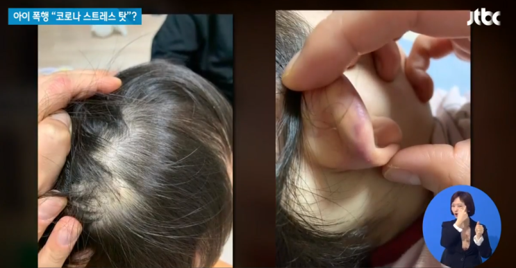  파주 어린이집 폭행 사건 청원 주소입니다