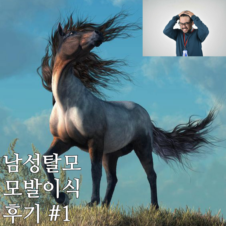  지키고 싶은 머리카락,  남성 탈모, 모발이식 상담 후기 #1
