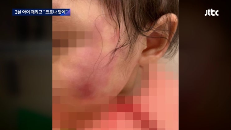  파주 어린이집 3살 원아 폭행 코로나스트레스 원인