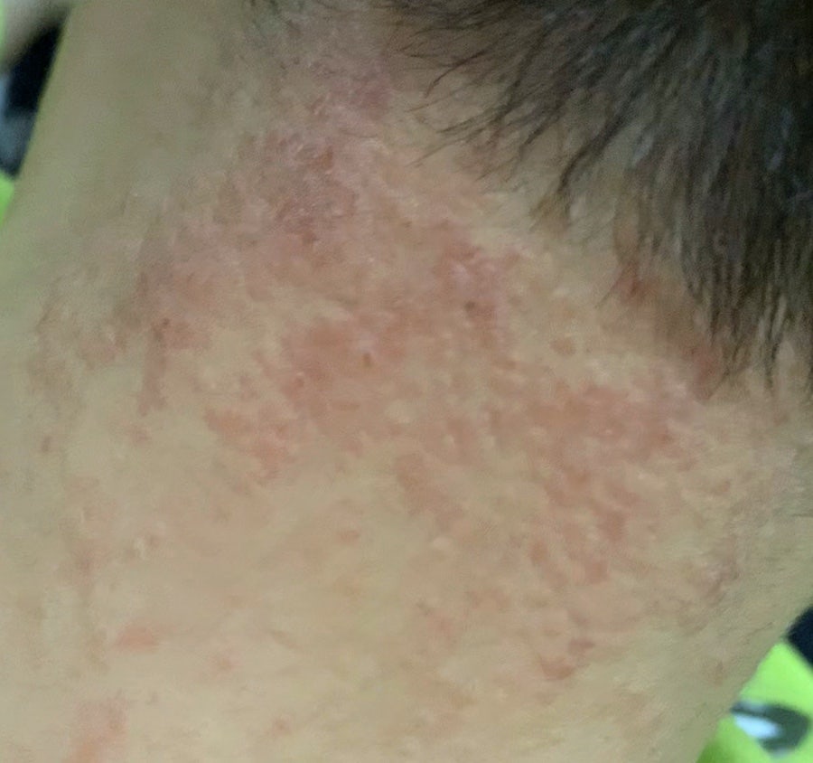 임성빈피부과비뇨기과 사진 4