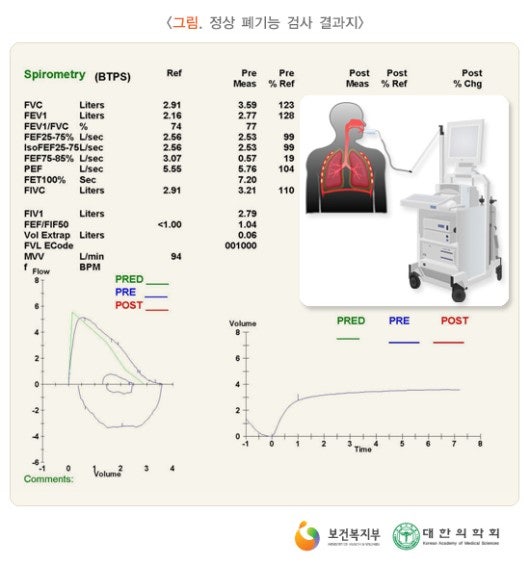 폐 기능 검사(PFT)
