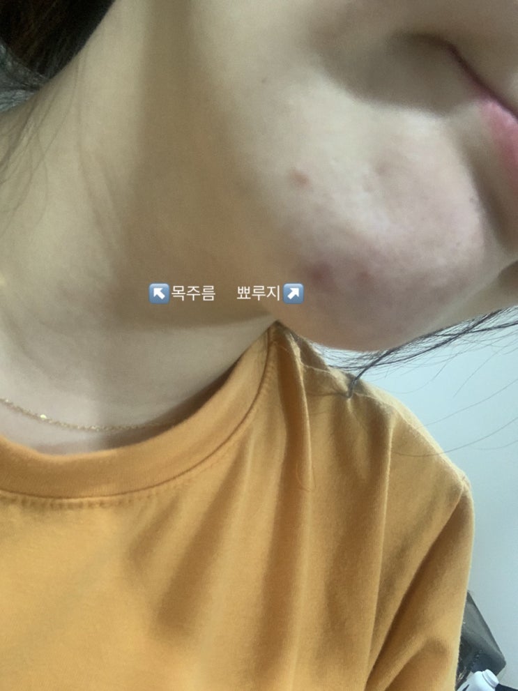  뉴스킨 180도 페이스워시 10일차 피부의 변화/ 안전하게 바르기 6탄